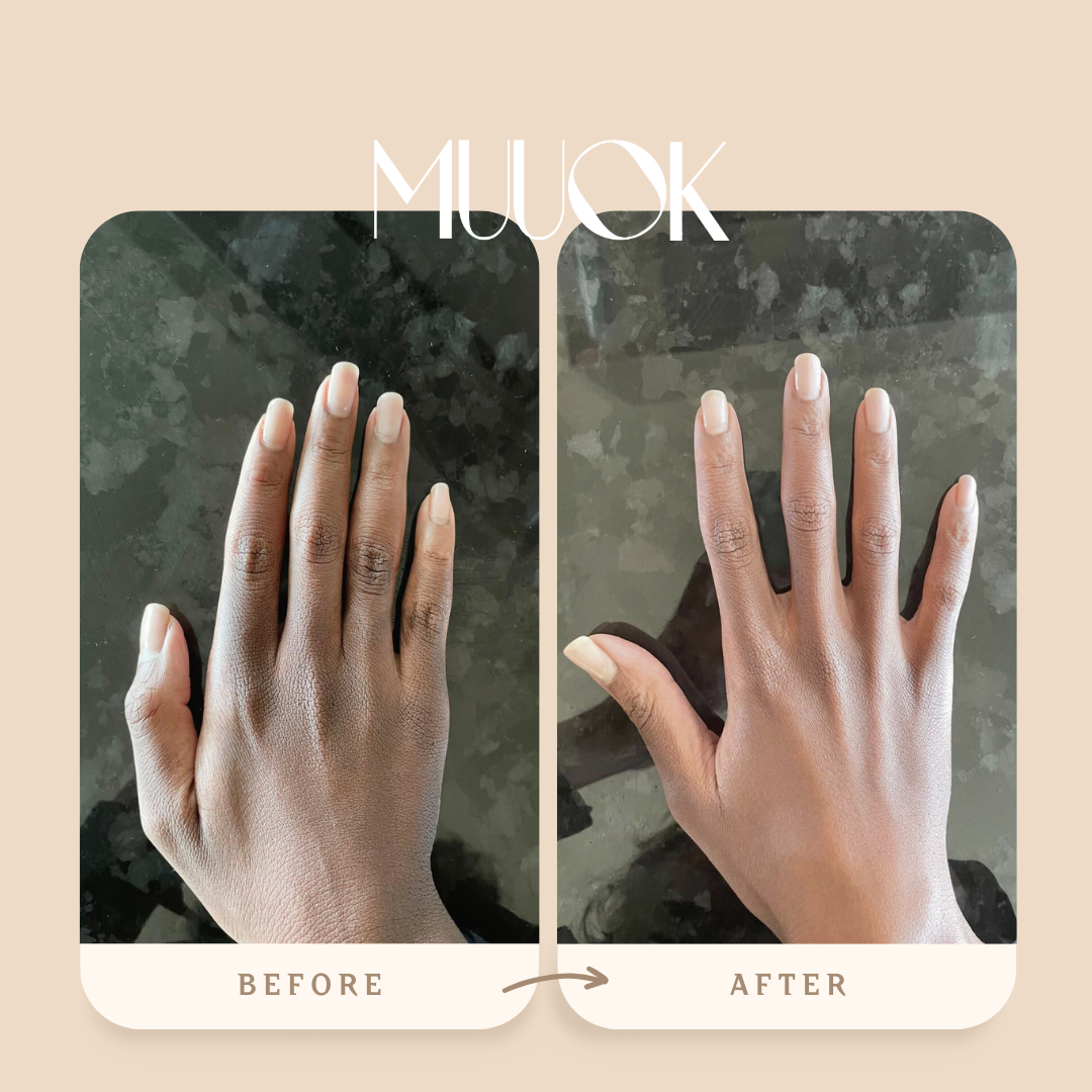 yene-elixir-before-and-after